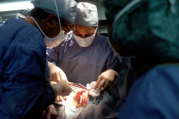 doctors performing surgery